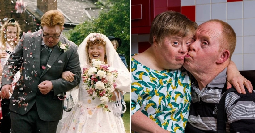 For better or for worse: spouses with Down syndrome celebrated their 28th wedding anniversary