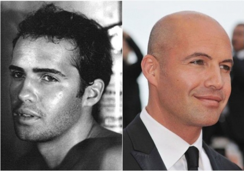 Former density: what did the star actors look like before they shone bald