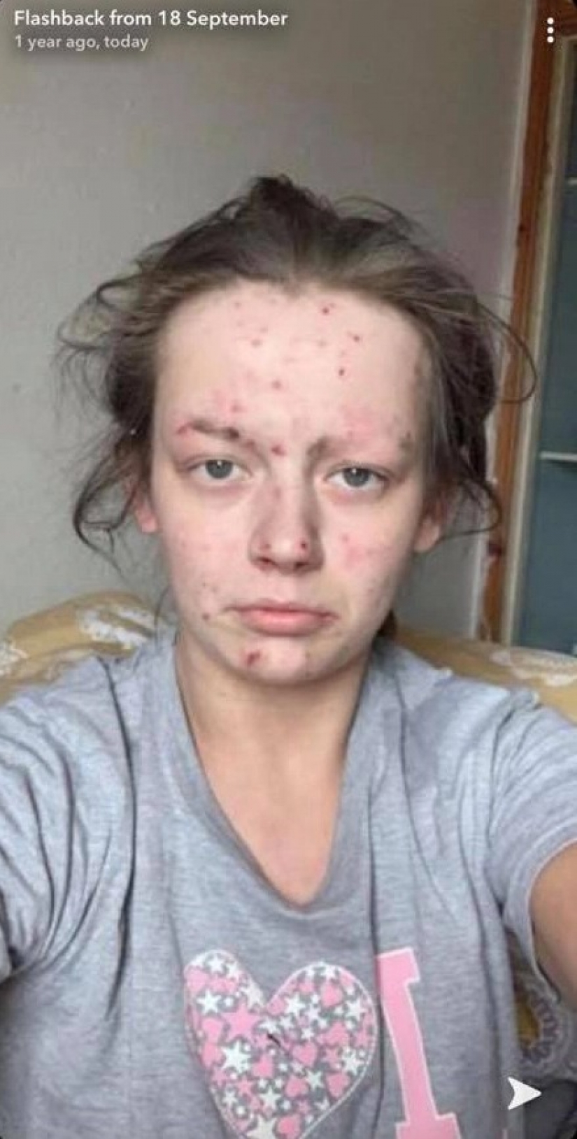 From a frog to a princess: a former drug addict became a beauty, getting rid of addiction