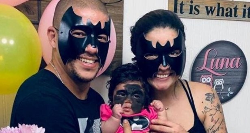 From Batman to Princess: Russian doctors removed a huge birthmark from the face of a 2-year-old American woman