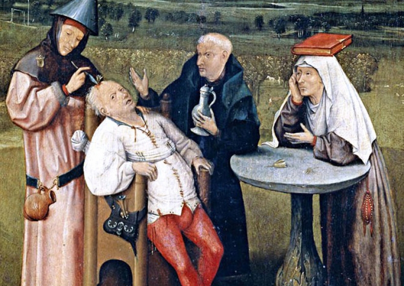 From trepanation to sewing garlic: ancient ways to treat migraines that make you feel uncomfortable