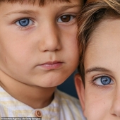 Genes multicolores: los hermanos de Turquía con heterocromía rara fascinan a primera vista