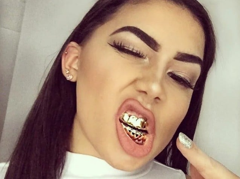 Is it fashionable? I give you a tooth! How outrageous fashion crept into dentistry