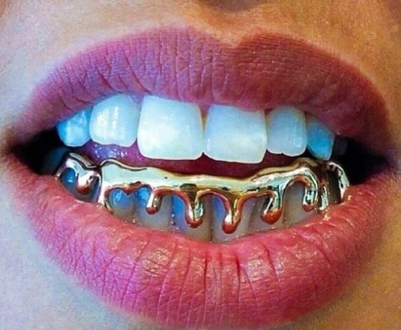 Is it fashionable? I give you a tooth! How outrageous fashion crept into dentistry