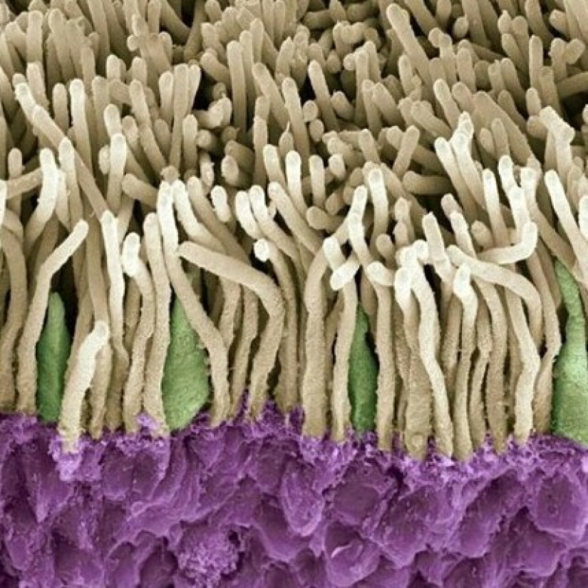 La belleza dentro de: un microbiólogo de la Ufa muestra en instagram los virus y bacterias que viven en nosotros