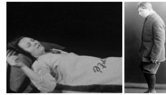 La epidemia de la Enfermedad del Sueño: una extraña enfermedad que convirtió a la gente en zombis vivos