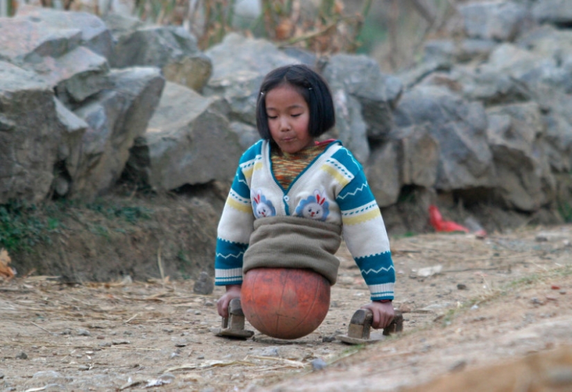 La heroína nacional de China: una chica con un baloncesto en lugar de piernas se convirtió en una atleta famosa