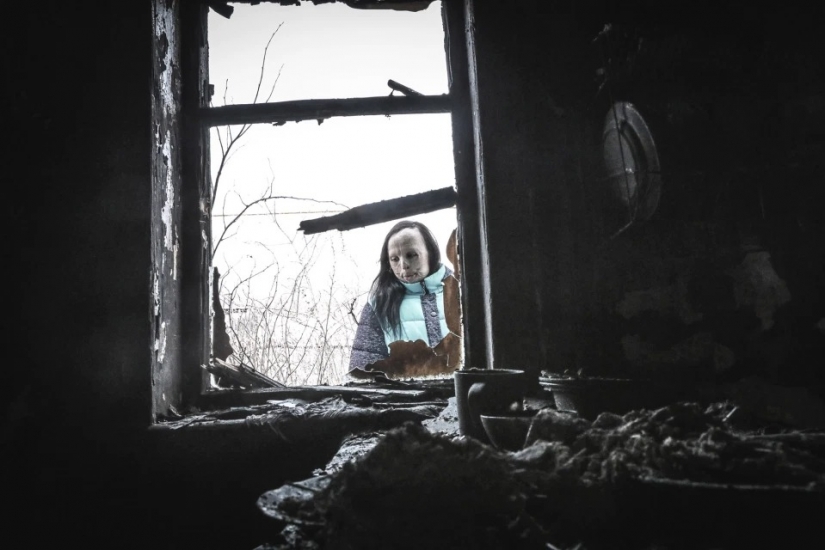 La historia de Ani boldyrevoy, que ha perdido la cara a causa del fuego, pero las esperanzas de una vida mejor