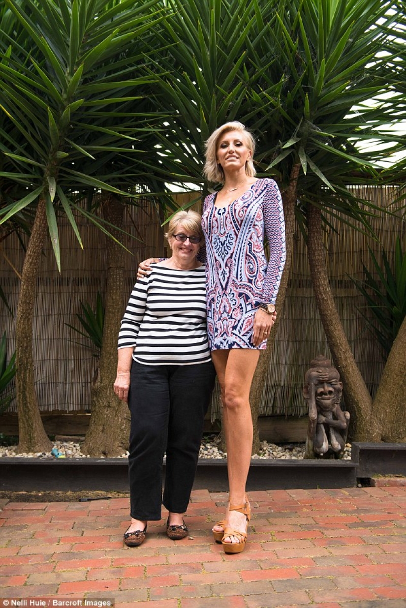 La madre de dos afirmó tener las piernas más largas del mundo