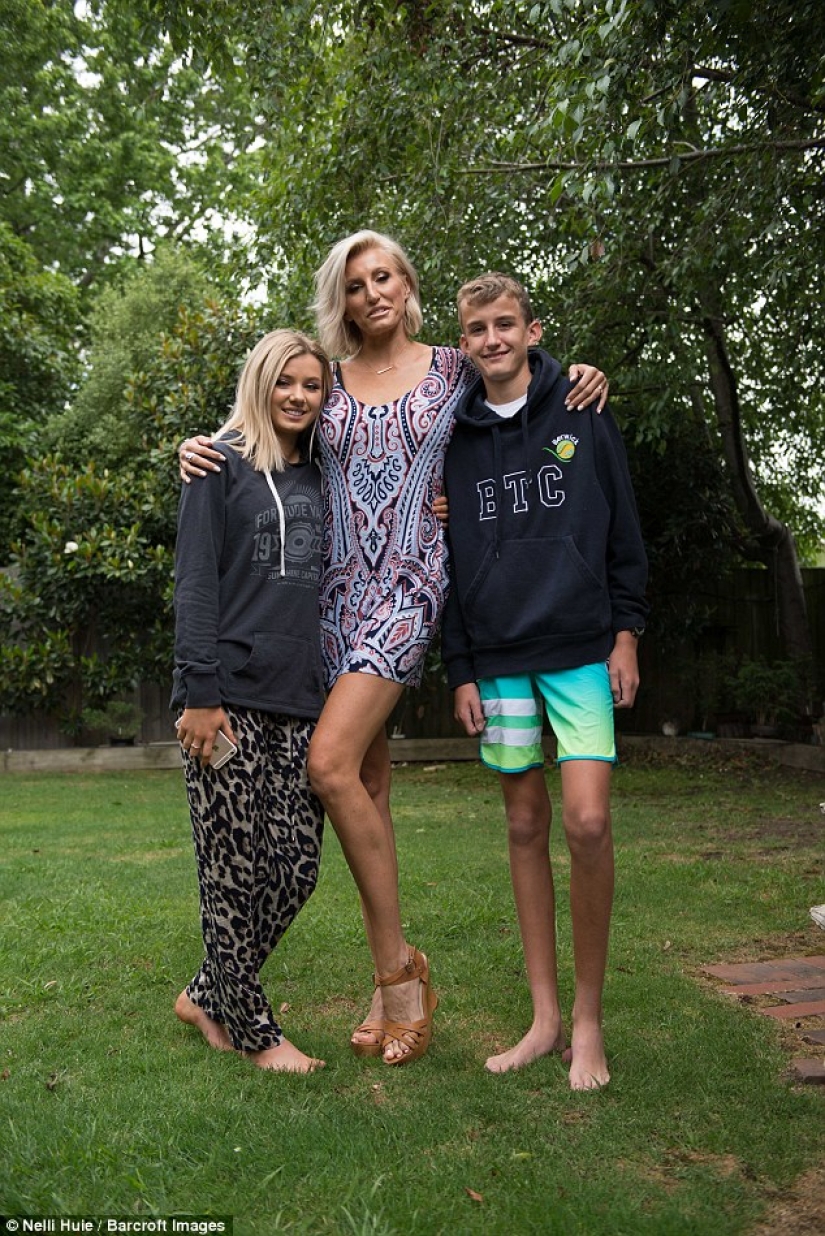 La madre de dos afirmó tener las piernas más largas del mundo