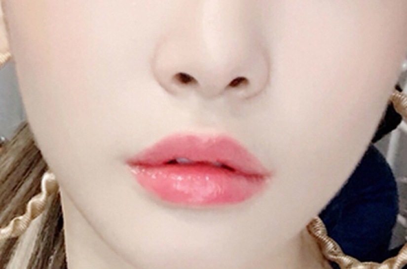 "Labios de cereza", reducción de mandíbula, fosas nasales de plástico: ¿qué operaciones son populares en Corea del Sur