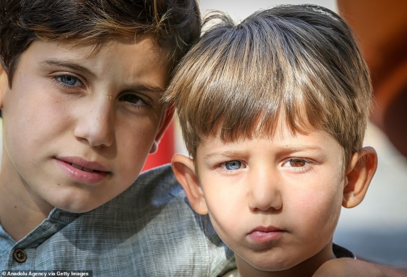 Multicolored genes: brothers from Turkey with rare heterochromia fascinate at first sight