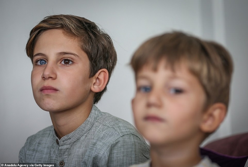 Multicolored genes: brothers from Turkey with rare heterochromia fascinate at first sight