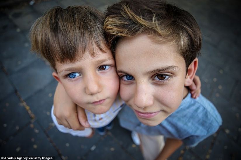 Multicolored genes: brothers from Turkey with rare heterochromia fascinate at first sight