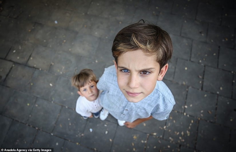 Multicolored genes: brothers from Turkey with rare heterochromia fascinate at first sight