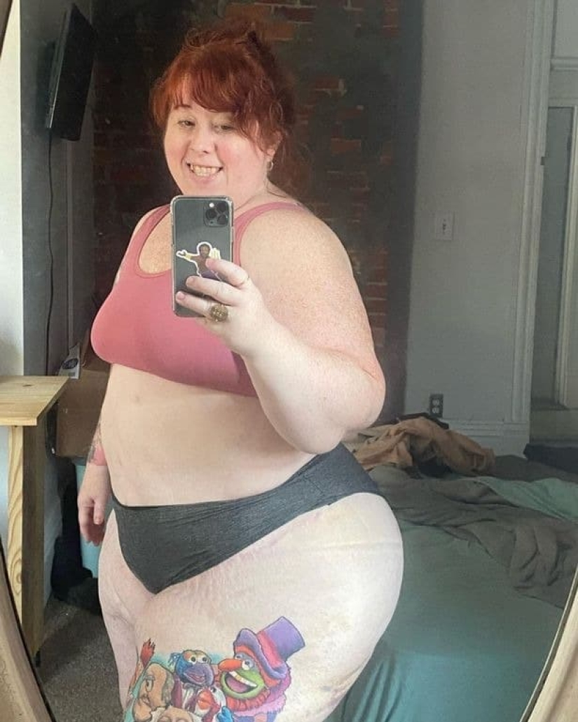 Not overeating, but a disease: an American woman is struggling with lipedema with the help of operations