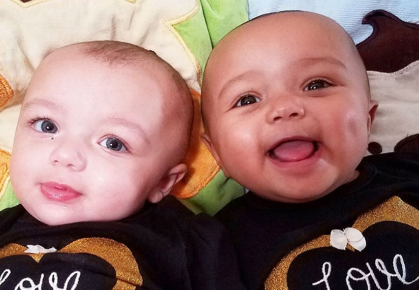 One is white, the other is tanned: a rare case of twins being born with different skin colors