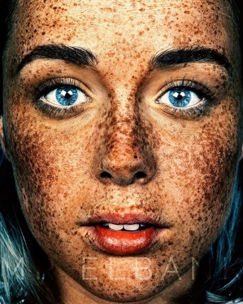 People with freckles are adorable