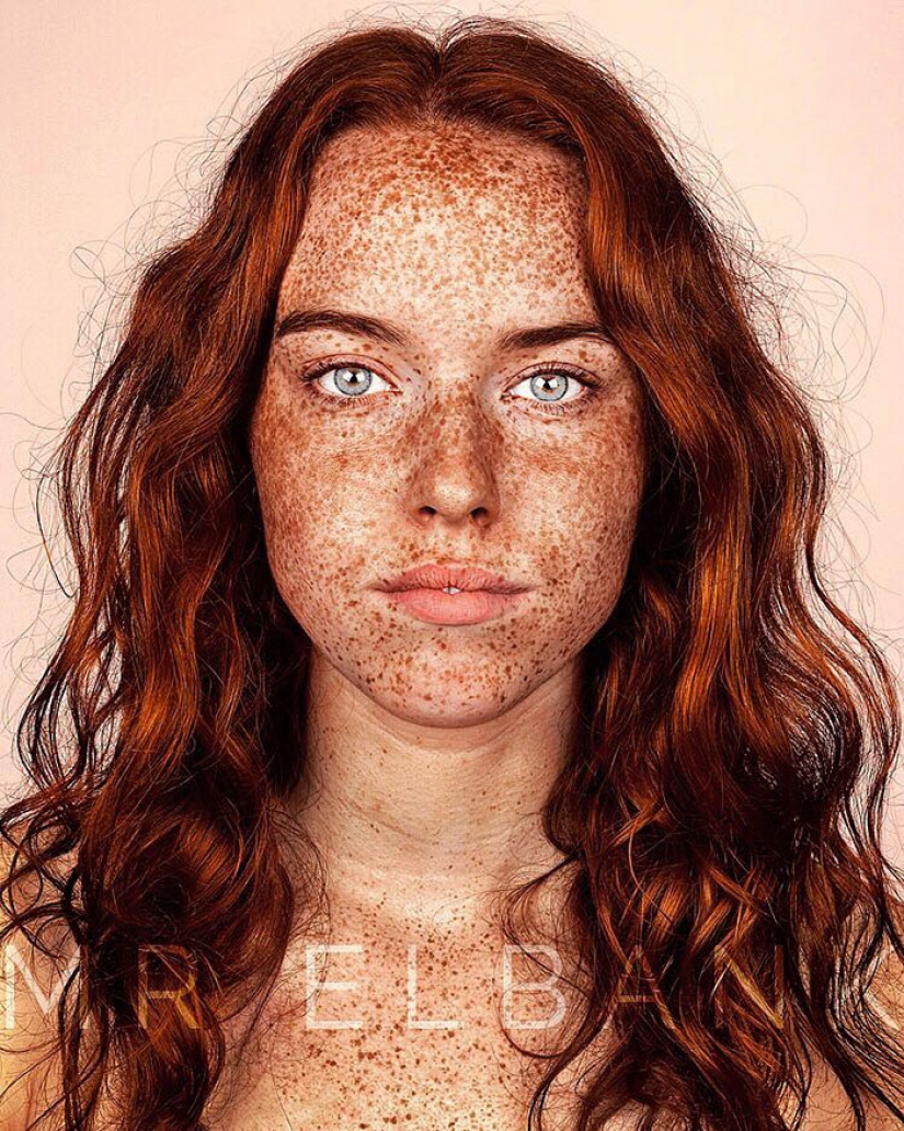 People with freckles are adorable
