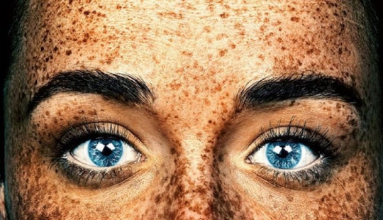 People with freckles are adorable