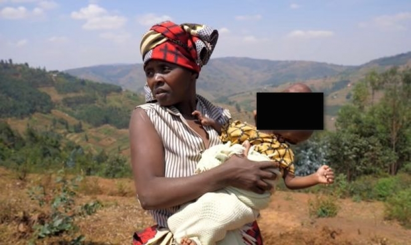 Relatives refused an African woman who gave birth to a baby with a head in the shape of a pear