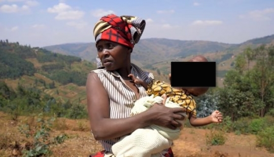 Relatives refused an African woman who gave birth to a baby with a head in the shape of a pear