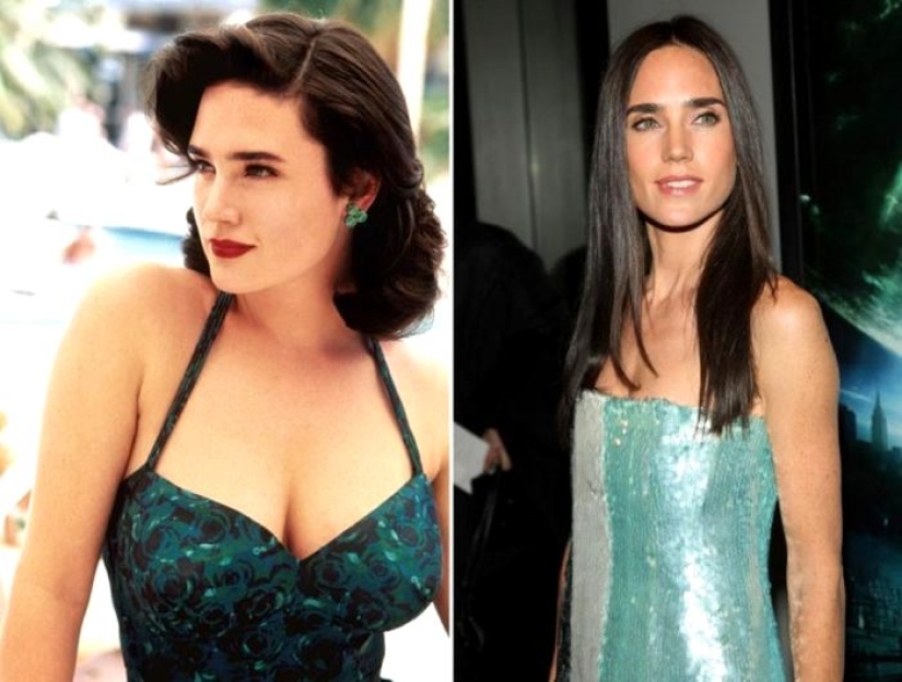 See above: Stars who have had breast reduction surgery