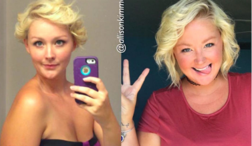 Ser delgada no significa ser feliz: una mujer estadounidense cambia la idea de "antes y después"fotos