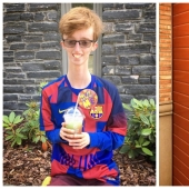 Ser quien eres: Un chico de Escocia con una enfermedad rara inspira a otros