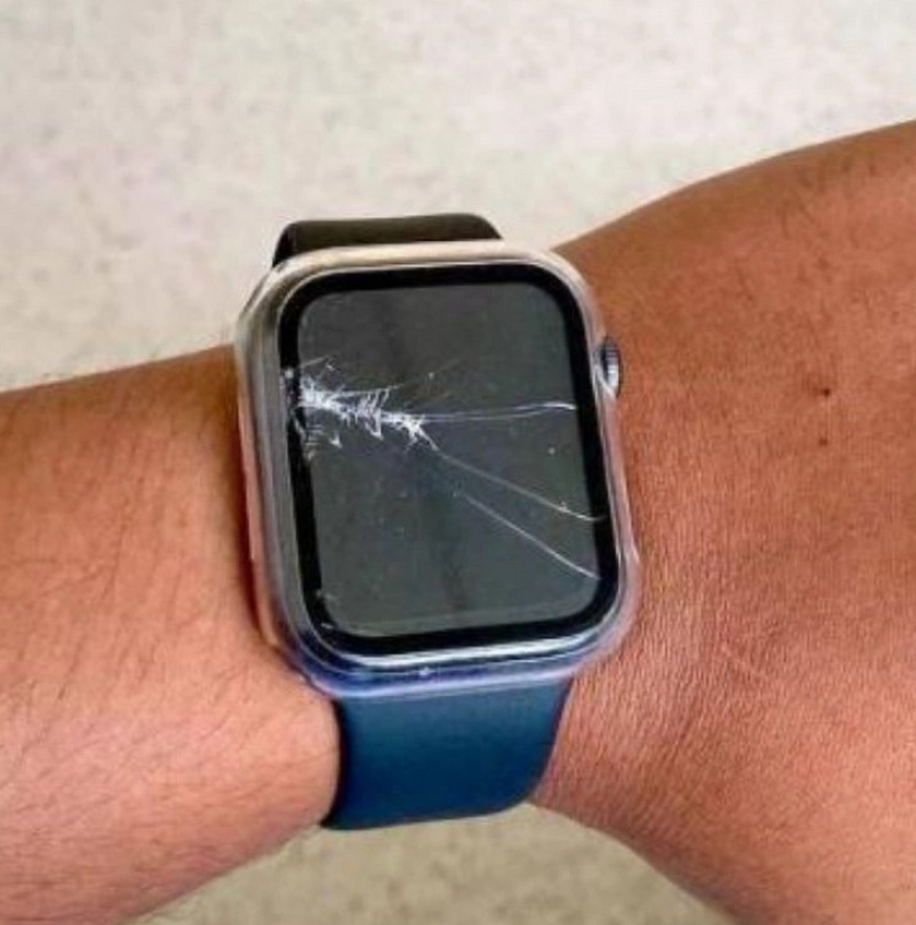 Smartwatch saved the owner's life after a serious accident on a deserted highway