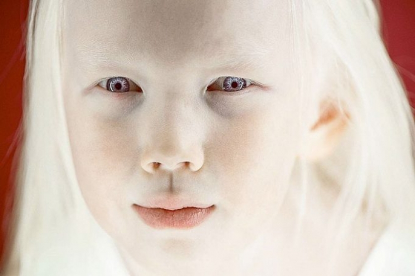 Snow White from Yakutia - an 8-year-old girl with a rare appearance conquered the Internet