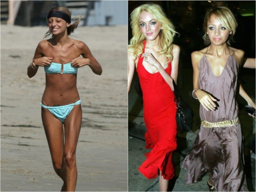 Star fever: which celebrities are faced with anorexia