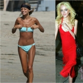 Star fever: which celebrities are faced with anorexia