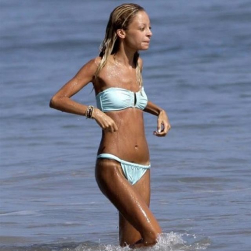 Star fever: which celebrities are faced with anorexia