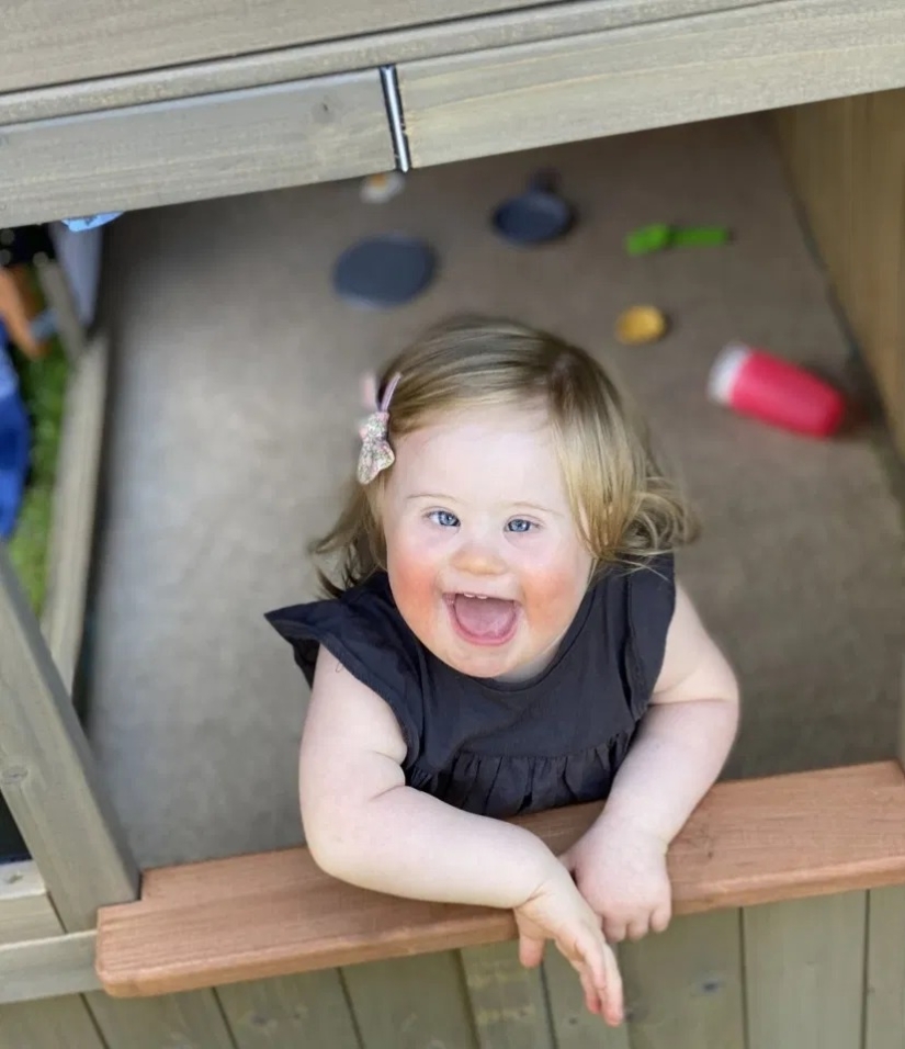 Sunny ray: A 2-year-old girl with Down syndrome has become the face of a fashion brand