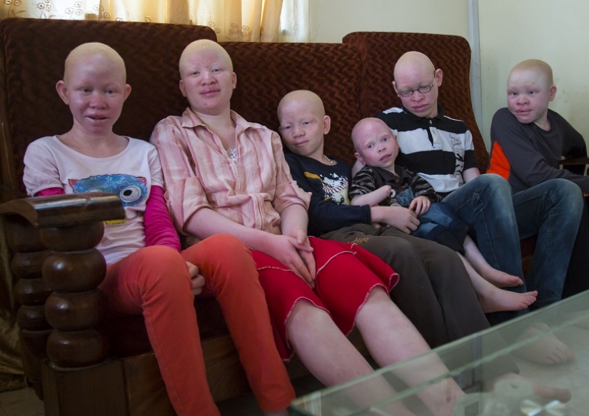 Tanzanian albinos, whose bodies are worth more than gold