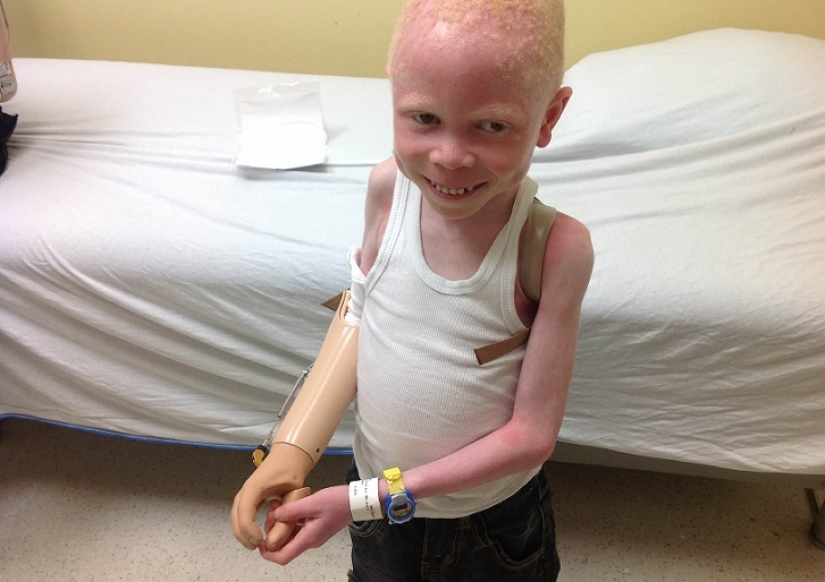 Tanzanian albinos, whose bodies are worth more than gold