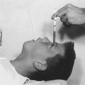 The 25 Most Amazing Treatments in History