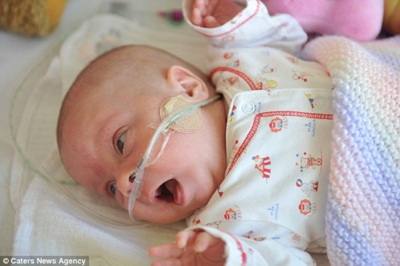 The amazing story of a tiny baby who survived no matter what