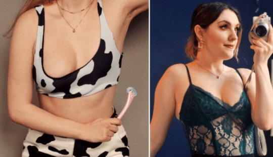 The Englishwoman, due to a rare disease, grew only one breast, but this did not make her unhappy The Englishwoman, due to a rare disease, grew only one breast, but this did not make her unhappy