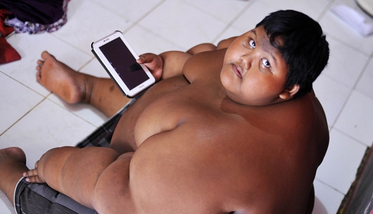 The fattest boy in the world lost beyond recognition: so it now looks