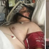 The man so let himself down that he almost died, but diet and sports saved him and made him handsome