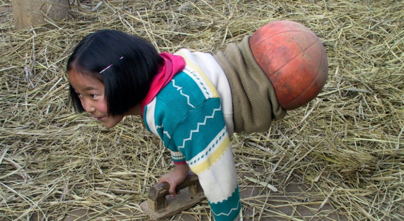 The national heroine of China: a girl with a basketball instead of legs became a famous athlete