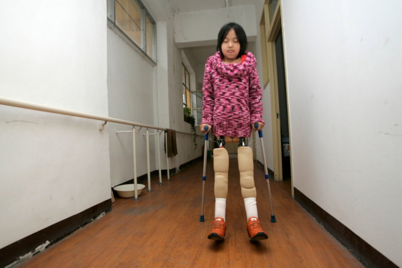 The national heroine of China: a girl with a basketball instead of legs became a famous athlete