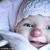 Una joven británica que nació con una mancha en la nariz ayuda a las personas con defectos en la apariencia