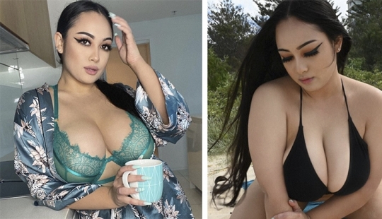 Una mujer australiana con senos en continuo crecimiento contó sobre su difícil vida