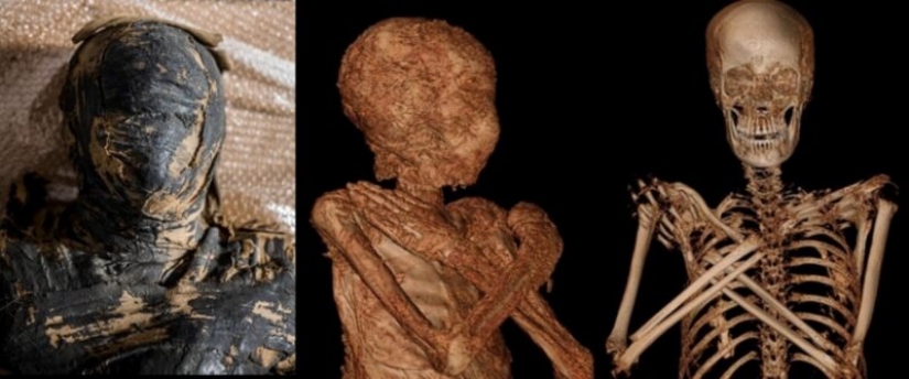 Unique find: Egyptian mummy turned out to be pregnant