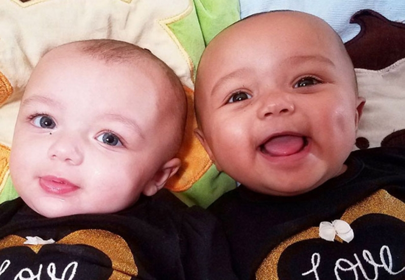 Uno es blanco, el otro bronceado: un caso raro de gemelos que nacen con diferentes colores de piel