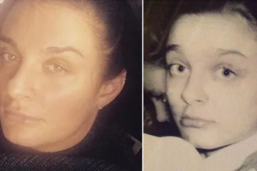 Valeria, Anastasia Zavorotnyuk and 8 other stars who proved that they did not do plastic surgery