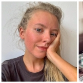 Vida envenenada: una mujer británica casi muere a causa de moho en la casa